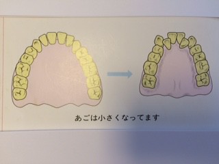 あご２