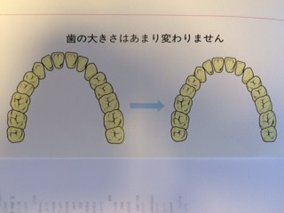 あご３