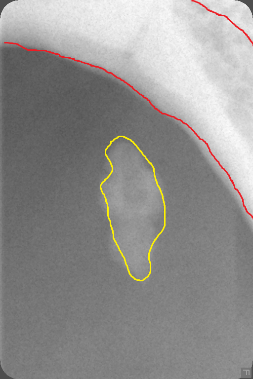 05072016_1951502