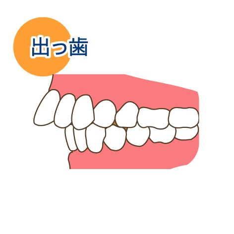 IH01