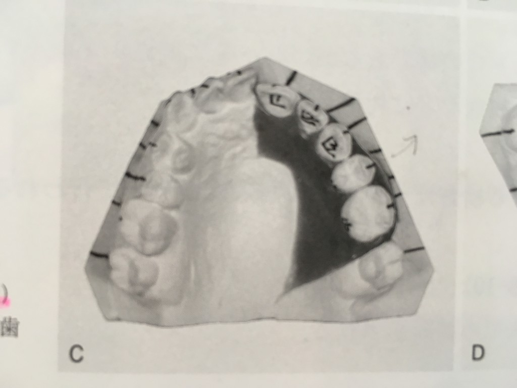 image11