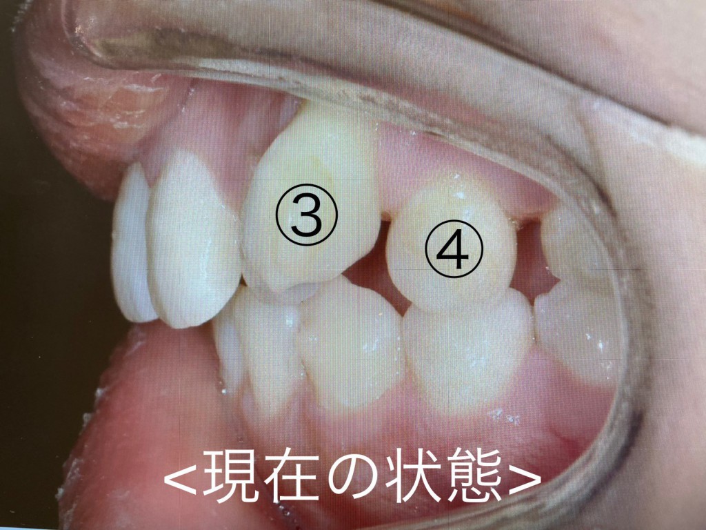 ＠＠＠＠＠＠