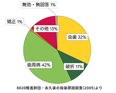 歯周病治療